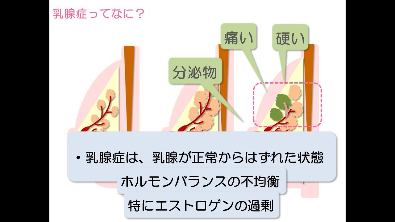乳腺 症 と は