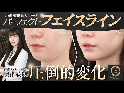 【究極の小顔整形】写真加工を現実にする顔の脂肪吸引/除去・糸リフト・ボトックス【パーフェクトフェイスライン/TAクリニック】