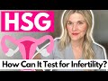 HSG Test: What is a Hysterosalpingogram? How Can It Test for Infertility?