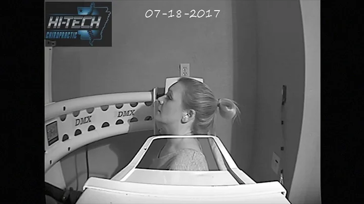 Forward Head Posture Neck Exercise (motion x-ray a...