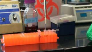 Serial Dilutions (10 fold)