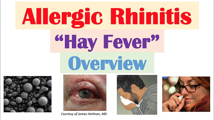 Allergic Rhinitis (Hay Fever): Risk Factors, Pathogenesis, Signs and Symptoms, Diagnosis, Treatment - DayDayNews