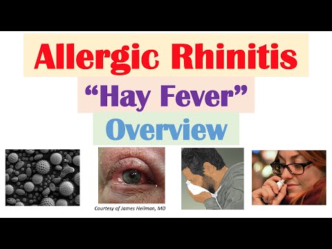 एलर्जिक राइनाइटिस (हे फीवर): जोखिम कारक, रोगजनन, संकेत और लक्षण, निदान, उपचार