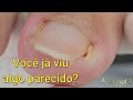 4 ANOS DE ALTOS E BAIXOS | Vamos começar do zero #satisfying #viral