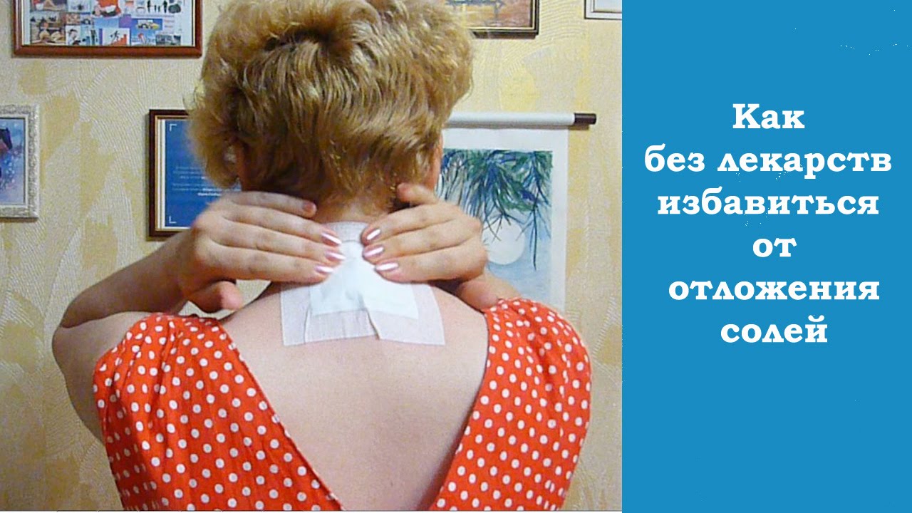 Отложение солей на шее: причины и лечение. Как убрать вдовий горб Отложение солей на шее: причины и лечение. Как убрать вдовий горб
