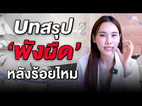 Patcha clinicบทสรุปพังผืดหลังการร้อยไหม บทสรุป พังผืดหลังการร้อยไหม