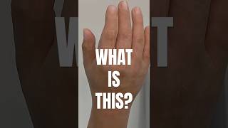 Ultra Realistic Prosthetic Hands