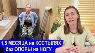 1,5 месяца на костылях без опоры на ногу: моё состояние, решающий снимок после Остеотомии