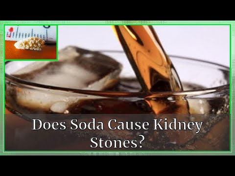 kidney soda stones cause