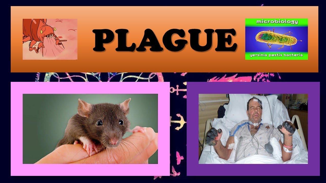 PLAGUE FULL EXPLANATION IN HINDI BYN.G MEDICALS YouTube