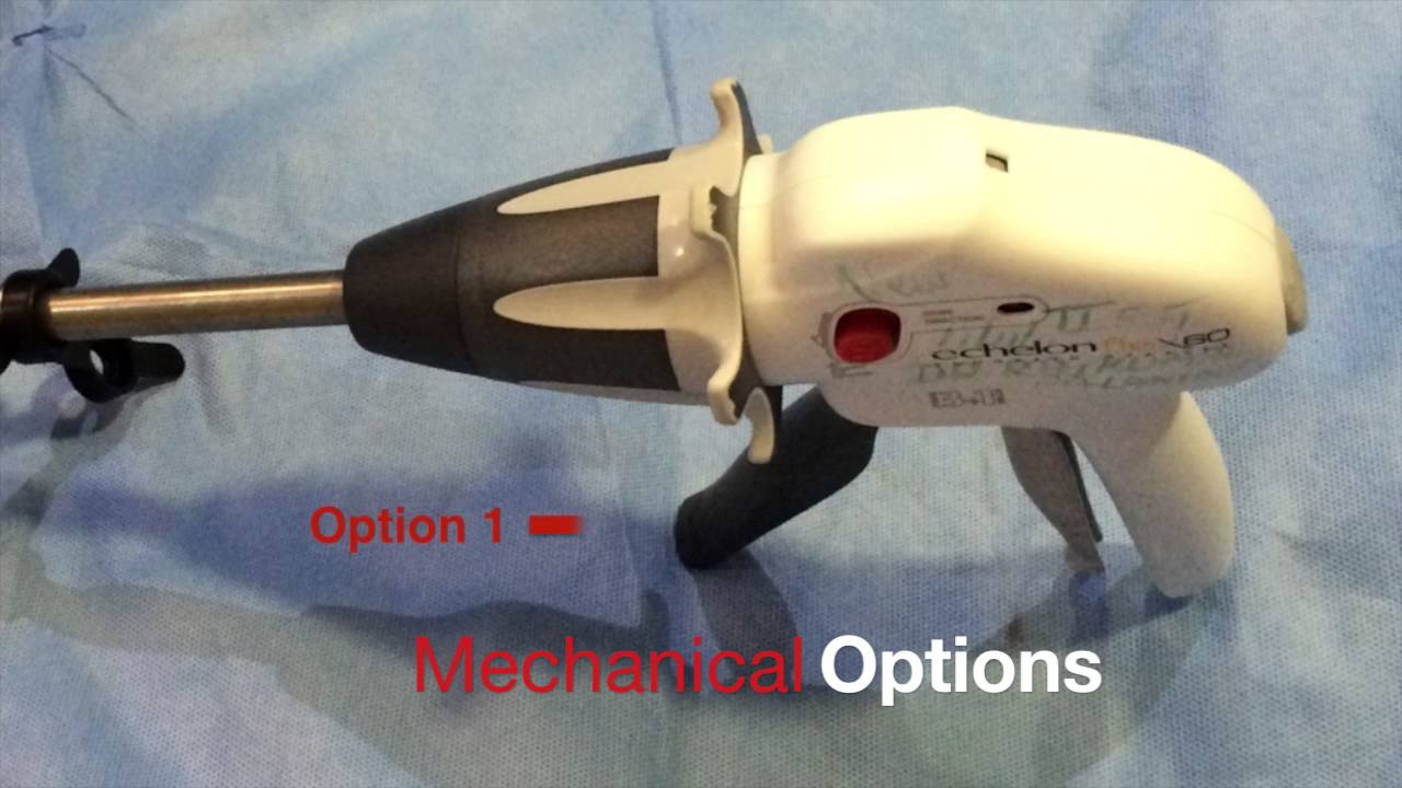 Stapler Misfire during Sleeve Gastrectomy YouTube