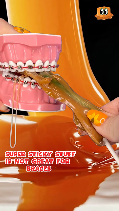 Is CARAMEL safe for BRACES!? *my REACTION #braces #caramel #satisfying