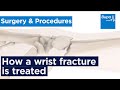 How a wrist fracture is treated | Bupa Health