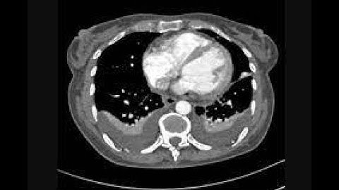 CT Heart segmentation using U-NET part three| evaluate the model شرح عربي