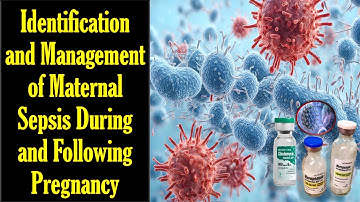 Identificatie en behandeling van maternale sepsis tijdens en na de zwangerschap / RCOG-richtlijn 24