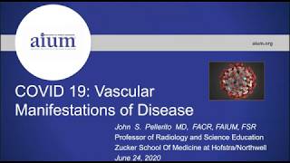 COVID-19: Vascular Manifestations of Disease