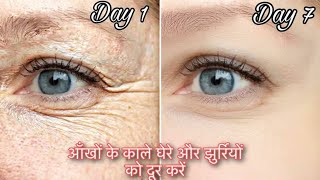 सिर्फ 7 दिन मे आखों के काले घेरे और झुर्रियों को दूर करने का तरीका। Remove under eye wrinkles