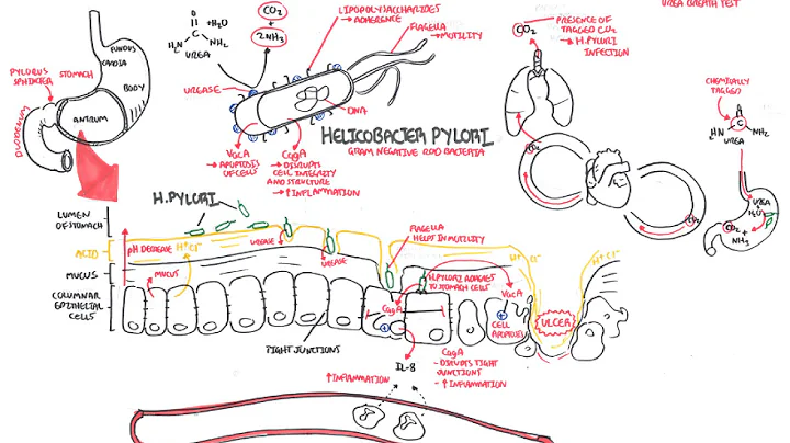 Helikobakter Pylori: Mide ve Duodenal Ülsere Neden Olan Bakteri