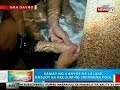 BP: Kamay ng bata, nasuot sa vacuum ng swimming pool sa Davao City