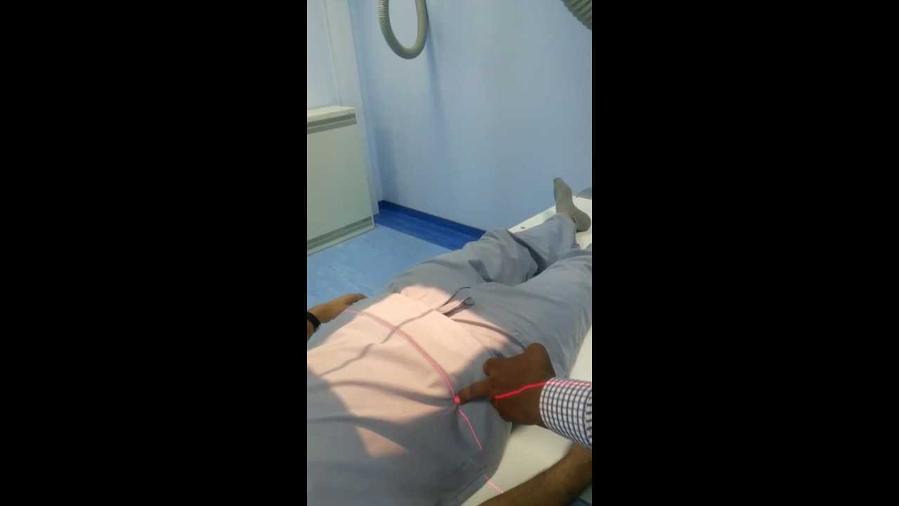 Ap Abdomen Supine Youtube