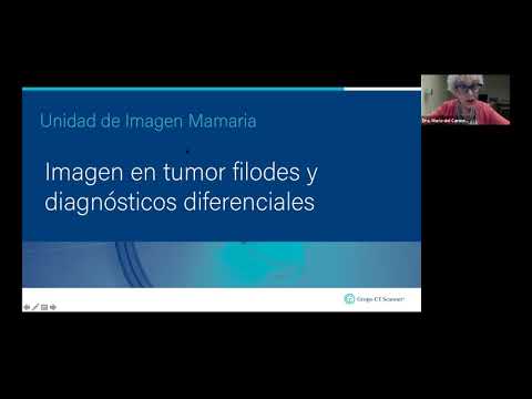 Imagen en tumor filodes y diagnósticos diferenciales.