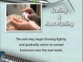 Scaling &amp; Root Planing Post Op Instruction. www.kmperio.co.uk