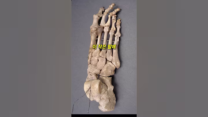 운동할때 발뼈가 이렇게 됩니다 ㅠ