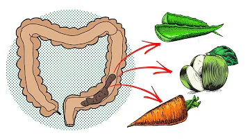 Come pulire il colon dalle feci?