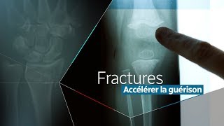 Vers une meilleure réparation des fractures