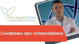 Синдромы при склеродермии: Рейно, Шегрена. Стадии ограниченной склеродермии