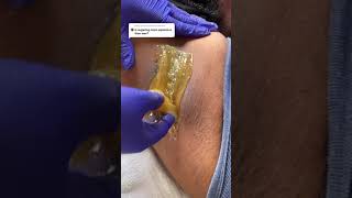 Sugaring vs Waxing: Waxing Underarm Using  DIY Sugar Wax #shorts