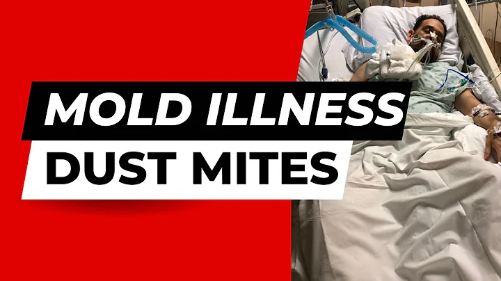 Dr. Gerald Rapp | Mold Illness | APS | CIRS | Dust...