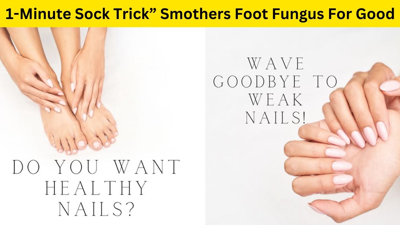 What Is The Sock Trick For Toenail Fungus