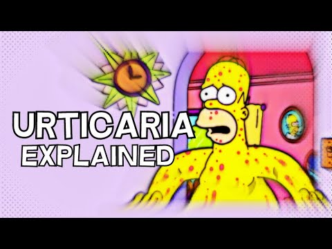 What is Urticaria (Hives) - EXPLAINED IN 3 MINUTES
