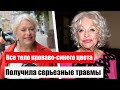 «Все тело кроваво-синего цвета»: Вдова Караченцова получила серьезные травмы