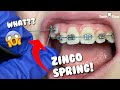 Dental Braces: Zingo Spring -Tooth Time New Braunfels Texas