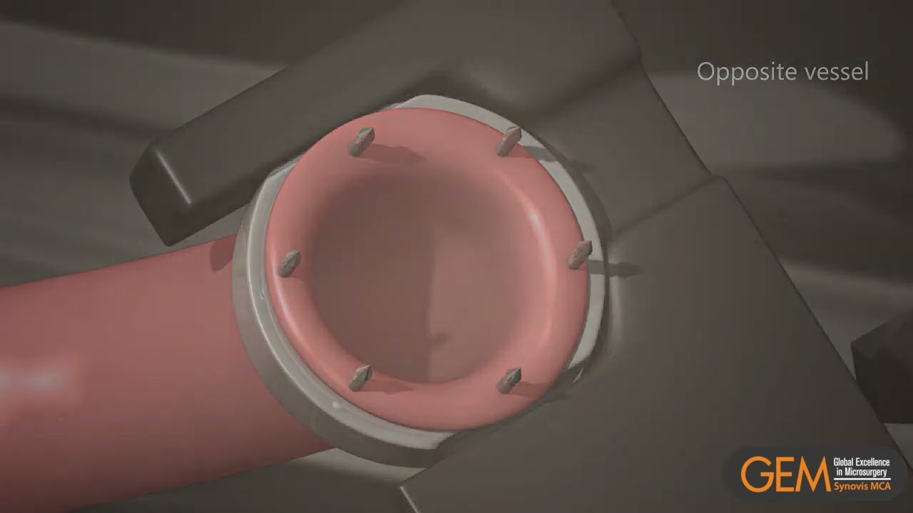 flow coupler and monitor video