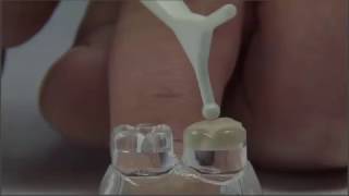 VOCO's new Glass Ionomer handling advantages