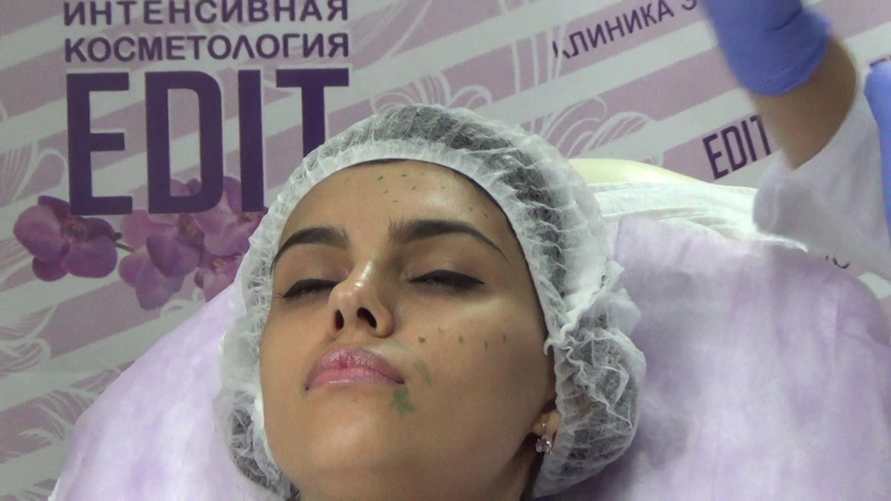 Биоревитализация: видео процедуры и советы косметологов Биоревитализация: видео процедуры и советы косметологов