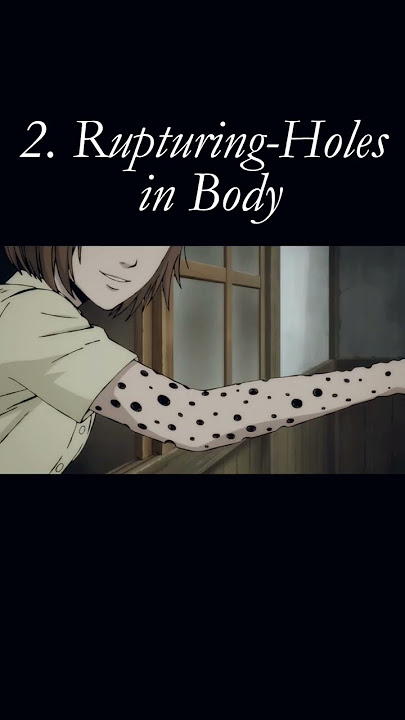 most cuelest diseases shown in Junji Ito Collection Anime. #anime #horror #junjiitocollection