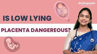 Can Low Lying Placenta Harm Your Fetus? | She The People