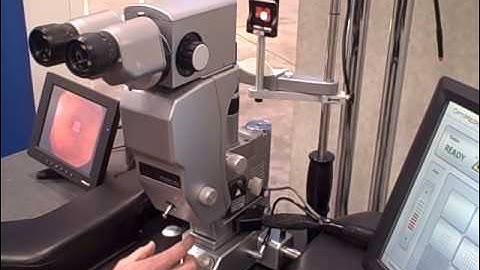 PASCAL (pattern scan laser) photocoagulator from Optimedica: A Customer Application