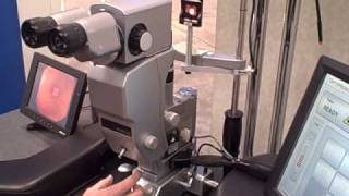 PASCAL (pattern scan laser) photocoagulator from Optimedica: A Customer Application