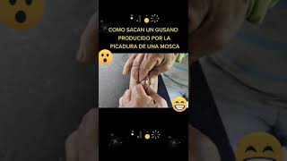 Apia Risaralda -🧐😲 Sacando Un Gusano 🪱 Producido Por Una Picadura De Una Mosca🪰😱 - Alex Montoya TV.