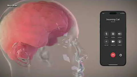 Elon Musk's Neuralink is seeking second person to test its brain chip