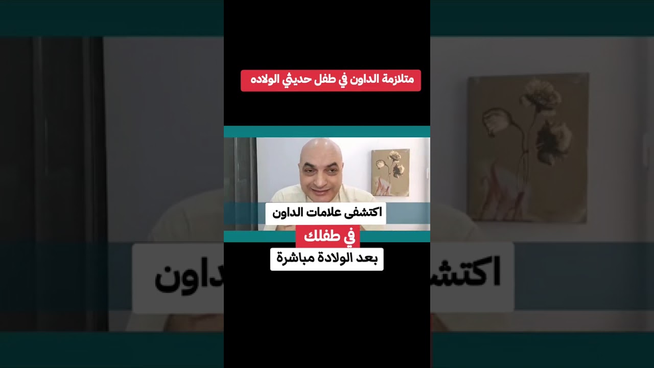 اكتشف علامات في طفلك بعد الولاده مباشره#دخالدكمال 