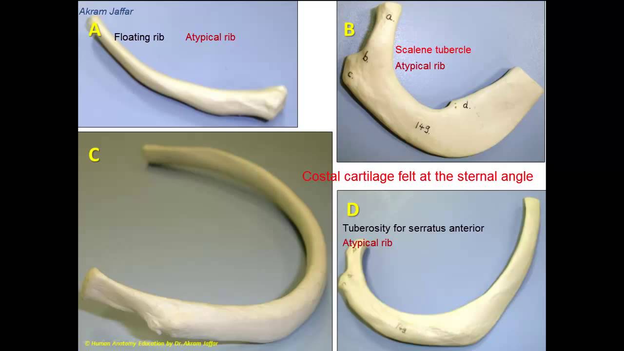 Some features of typical and atypical ribs - YouTube