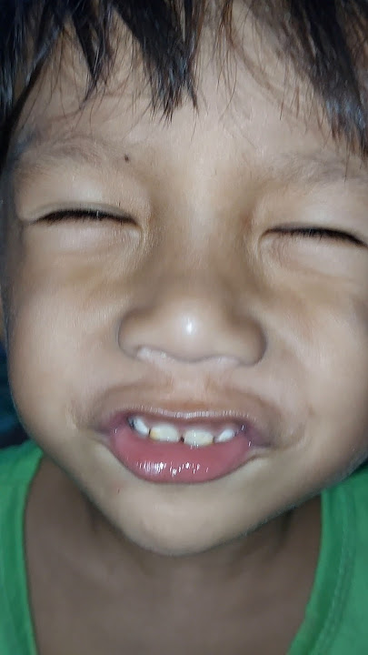 nyungir