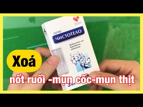 gel xóa nốt ruồi, mụn cốc, mụn thịt | xóa nốt ruồi nga