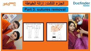 عملية شفط الدهون  الجزء الثالث -  Liposuction at 365mc hospital with Docfinderkorea part 3